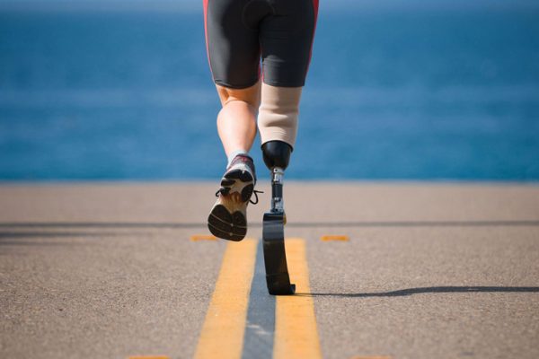 دویدن با پروتز پنجه کربنی امکان پذیر است؟